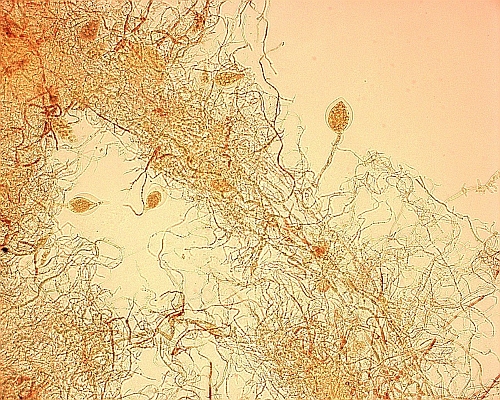 Snímek mycelia polycentrické houby Anaeromyces mucronatus KF4 ve světelném mikroskopu